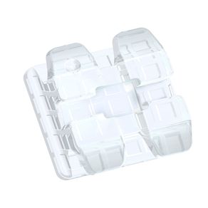 10.87.2111 Bráquete Cerâmico New Ice Clear Roth 0,022 (Dente 11) - Orthometric